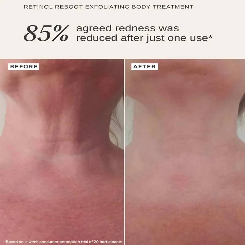 Alpha-H Retinol Reboot Exfoliating Body Treatment with 1% Encapsulated Retinol