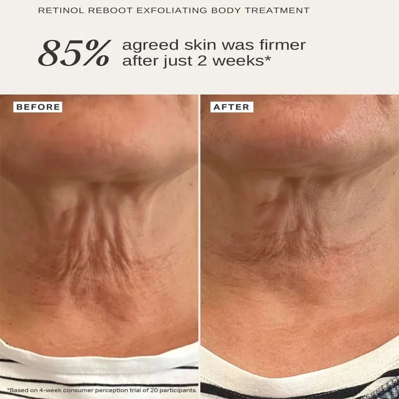 Alpha-H Retinol Reboot Exfoliating Body Treatment with 1% Encapsulated Retinol